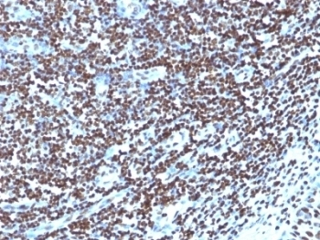 Formalin-fixed, paraffin-embedded human tonsil stained with Histone antibody (1415-1)