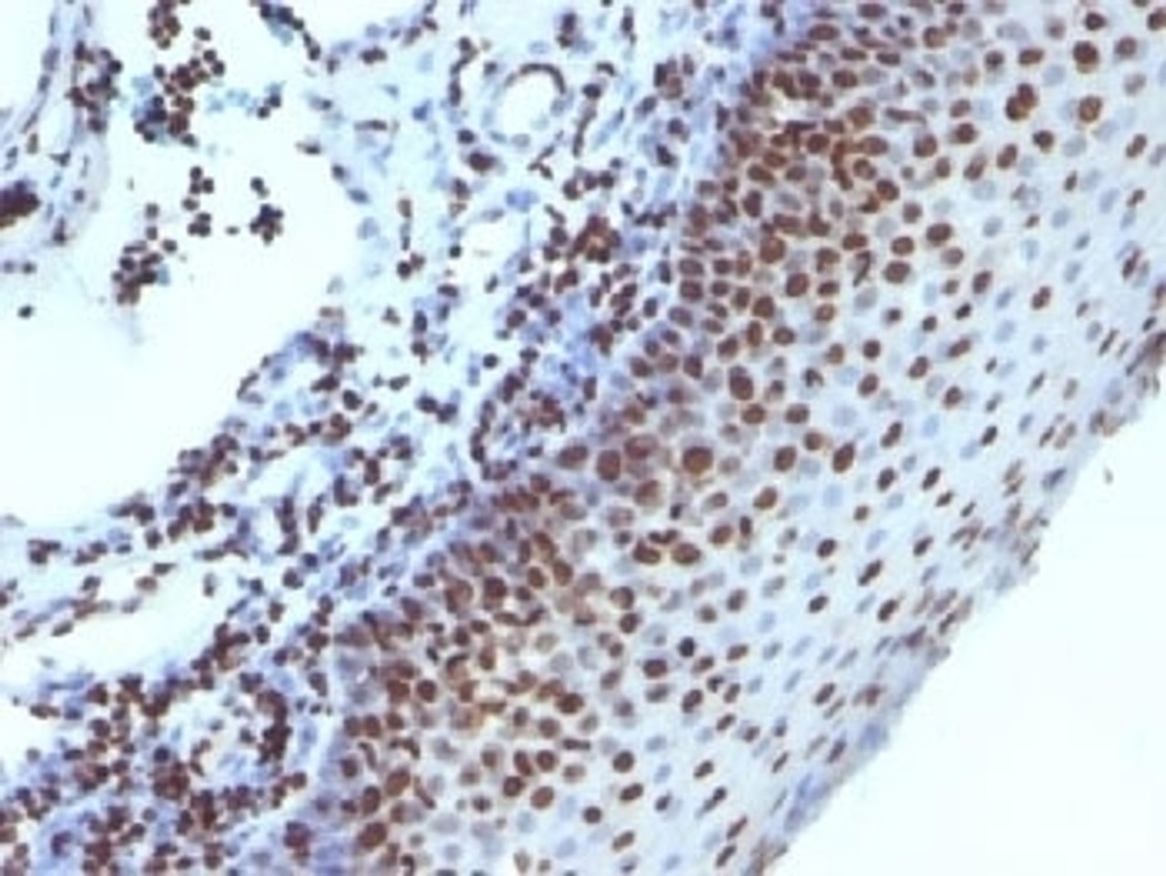 Formalin-fixed, paraffin-embedded human tonsil stained with Histone antibody (1415-1)