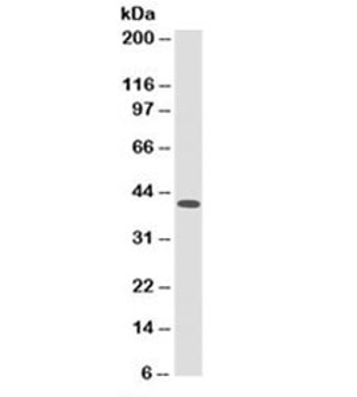 Western blot testing of ThP-1 cell lysate with HLA-ABC antibody. Expected molecular weight of A/B/C: 40-41kDa.