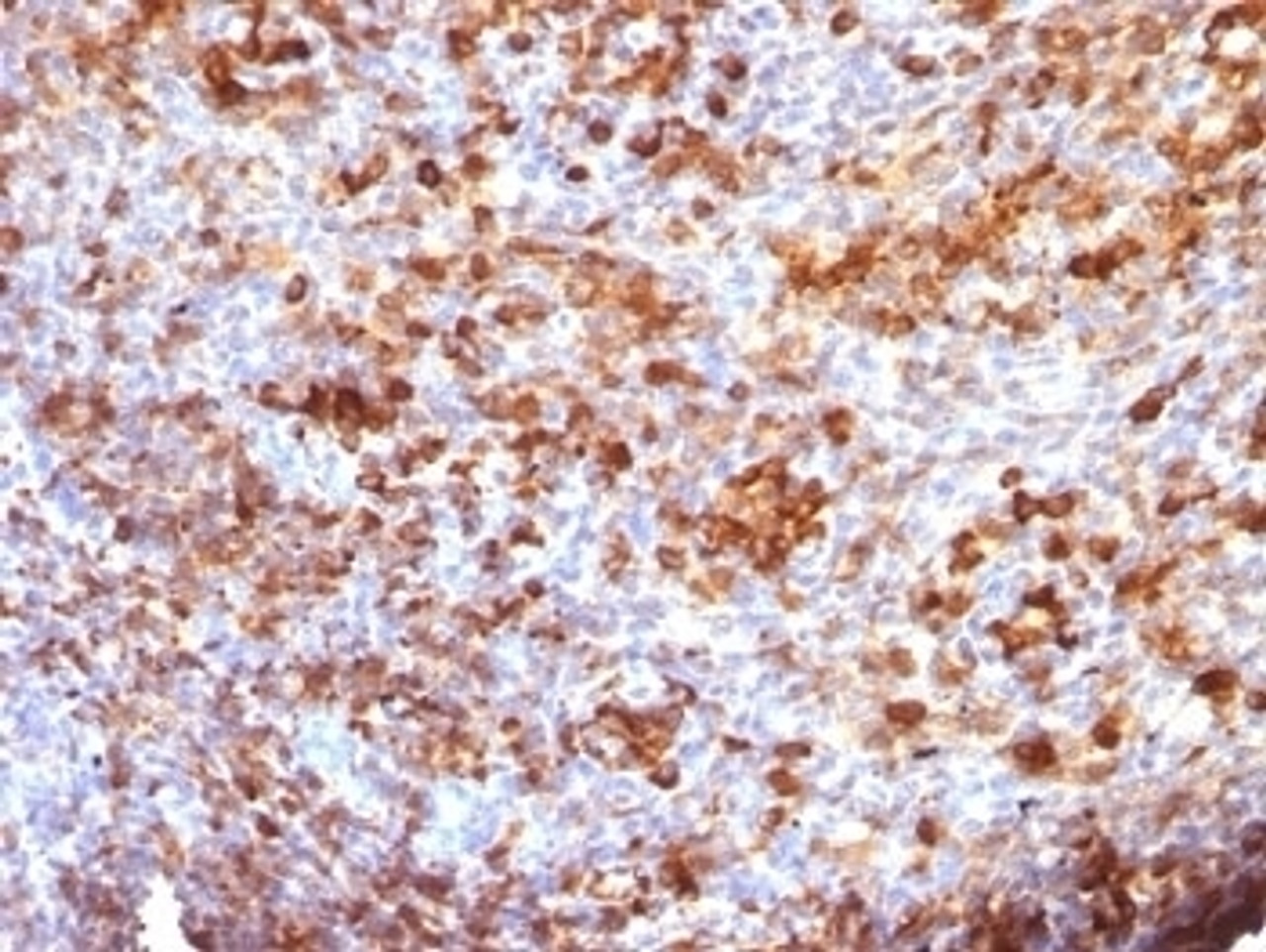 Formalin-fixed, paraffin-embedded human tonsil stained with anti-IgG antibody (B33/20)