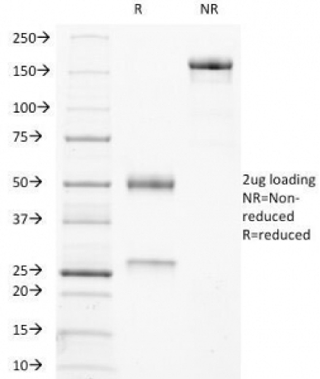 SDS-PAGE Analysis of Purified, BSA-Free TRAcP Antibody (ACP5/1070) . Confirmation of Integrity and Purity of the Antibody.