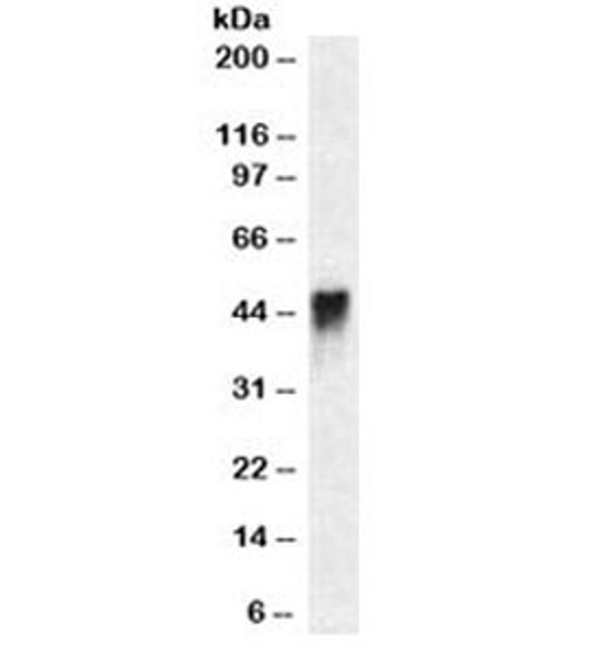 Western blot testing of Jurkat cell lysate with CD2 antibody (clone HuLy-m1) . Expected molecular weight ~47kDa.