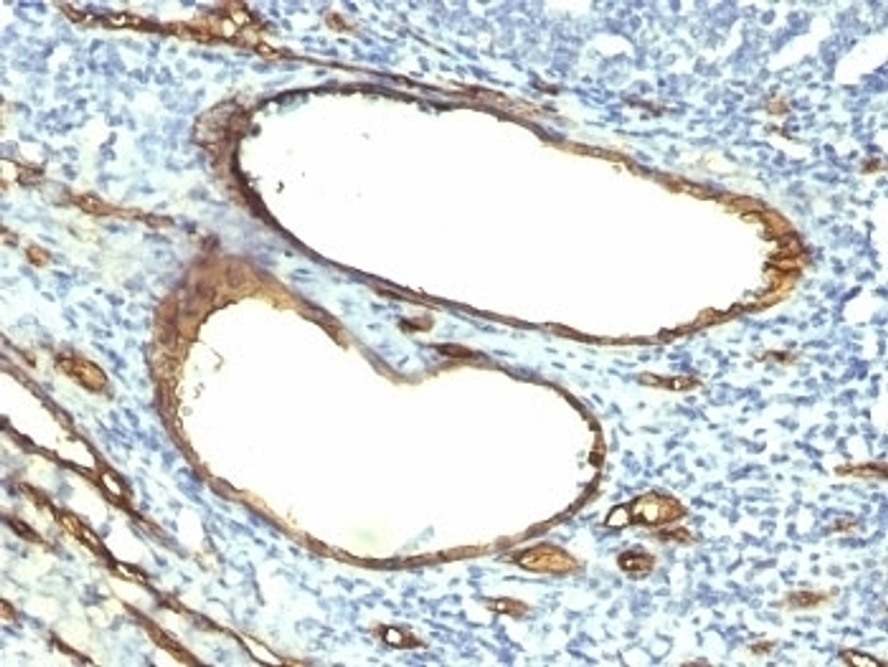 Formalin-fixed, paraffin-embedded human tonsil stained with CD34 antibody (HPCA1/763)