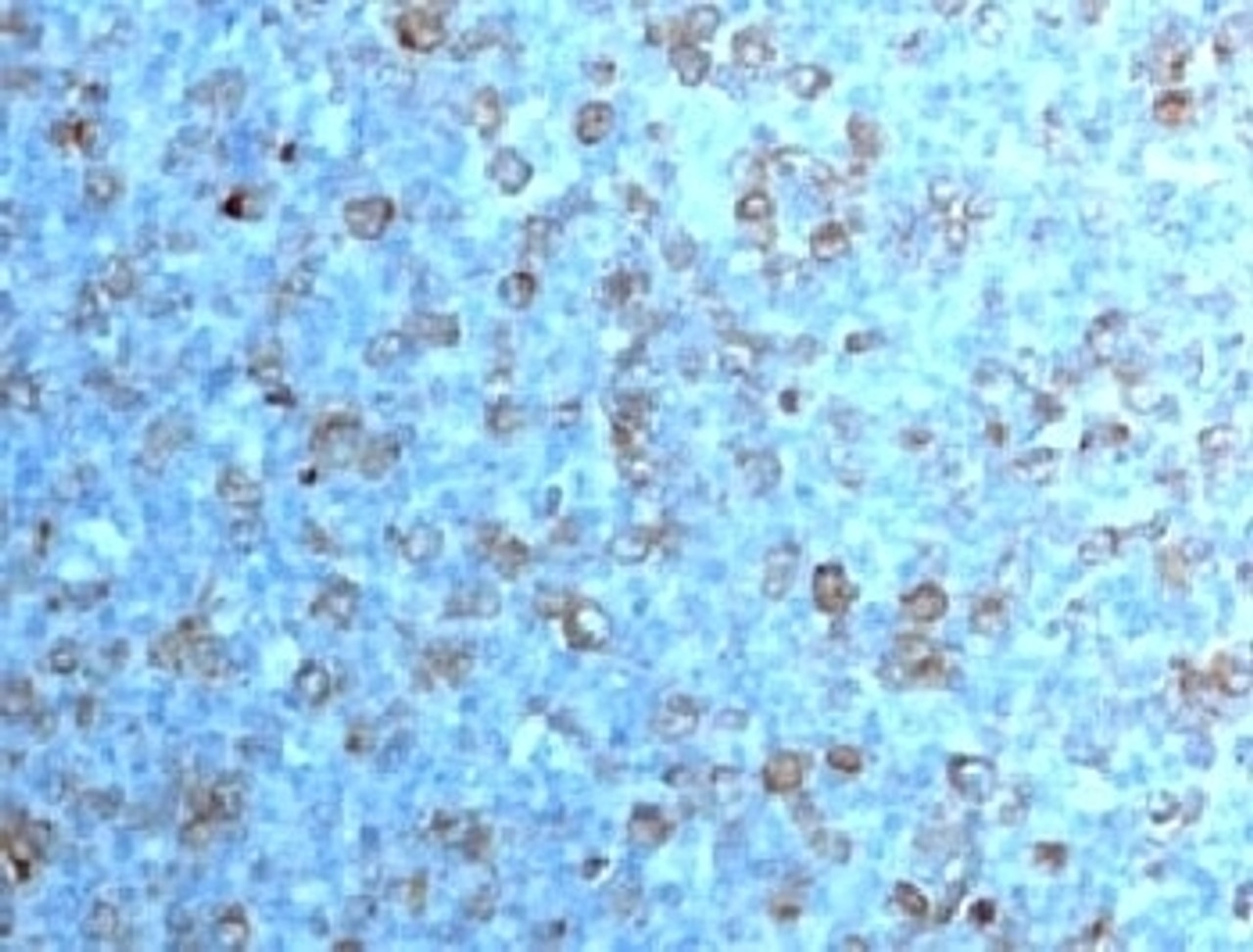 IHC testing of formalin-fixed, paraffin-embedded human tonsil with Cdc2 antibody (CDK1/873) .