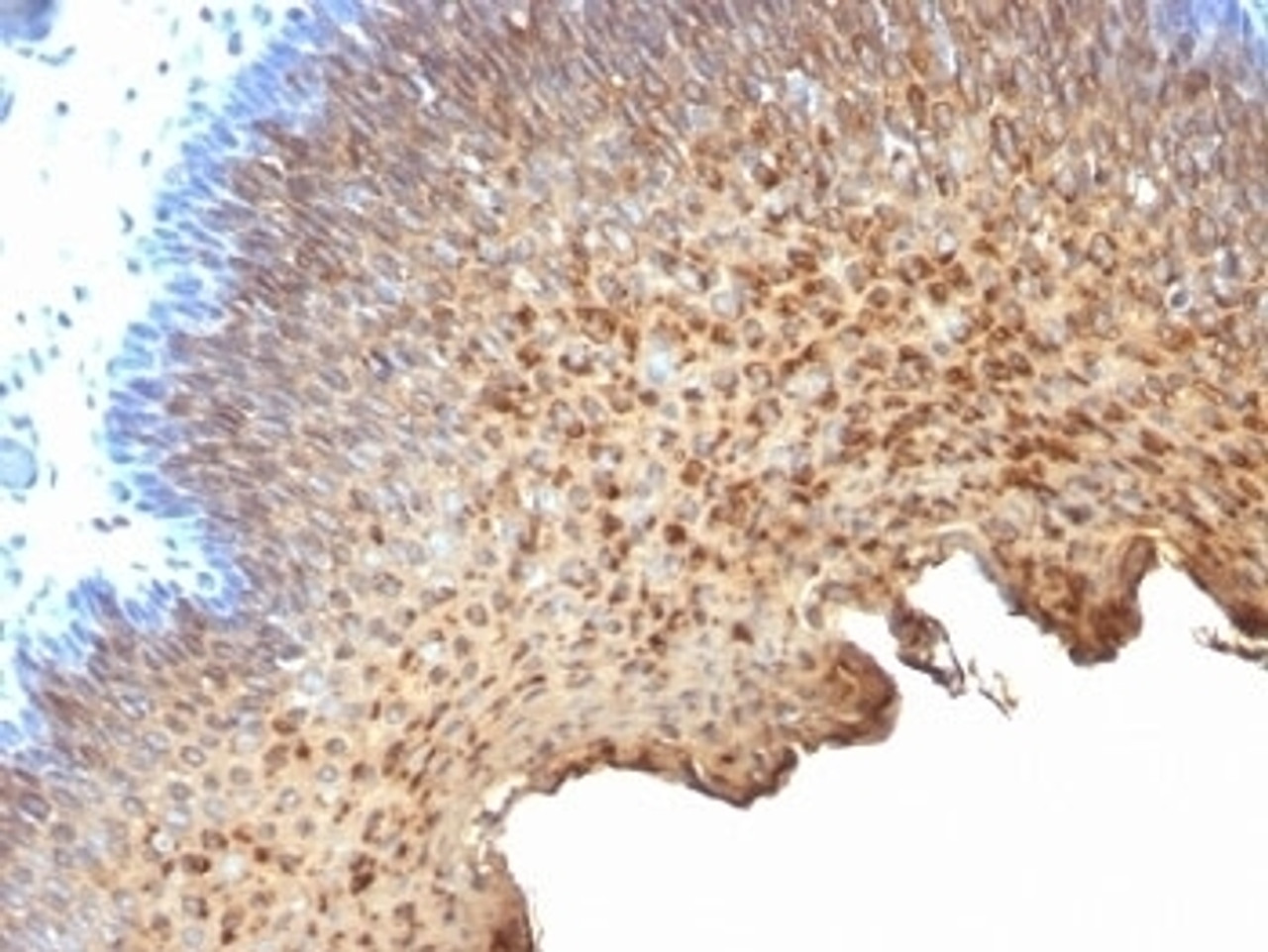 Formalin-fixed, paraffin-embedded human tonsil stained with Cytokeratin 10 + 13 antibody (SPM262)