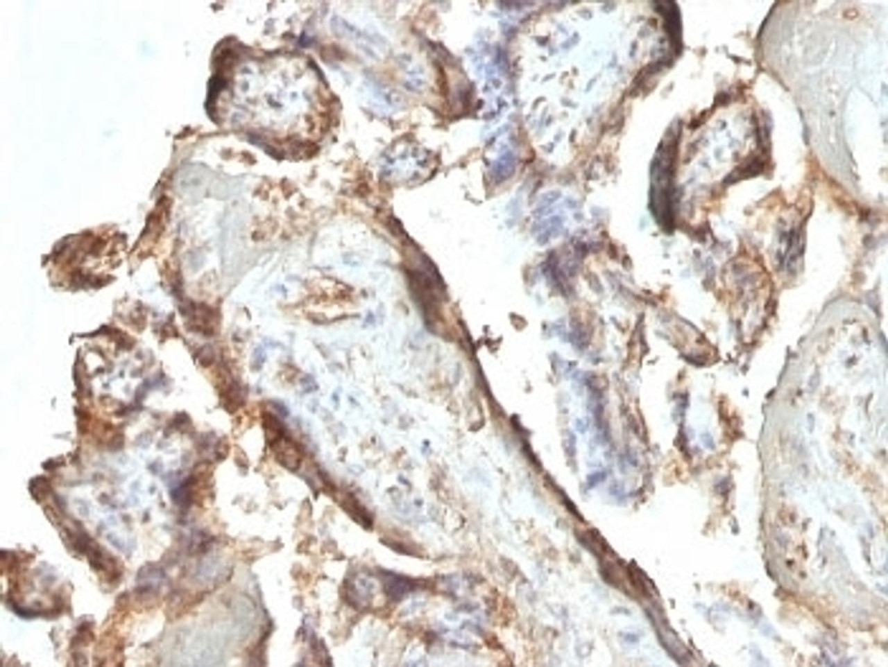 Formalin-fixed, paraffin-embedded human placenta stained with hCG Holo antibody (HCGab/52) .