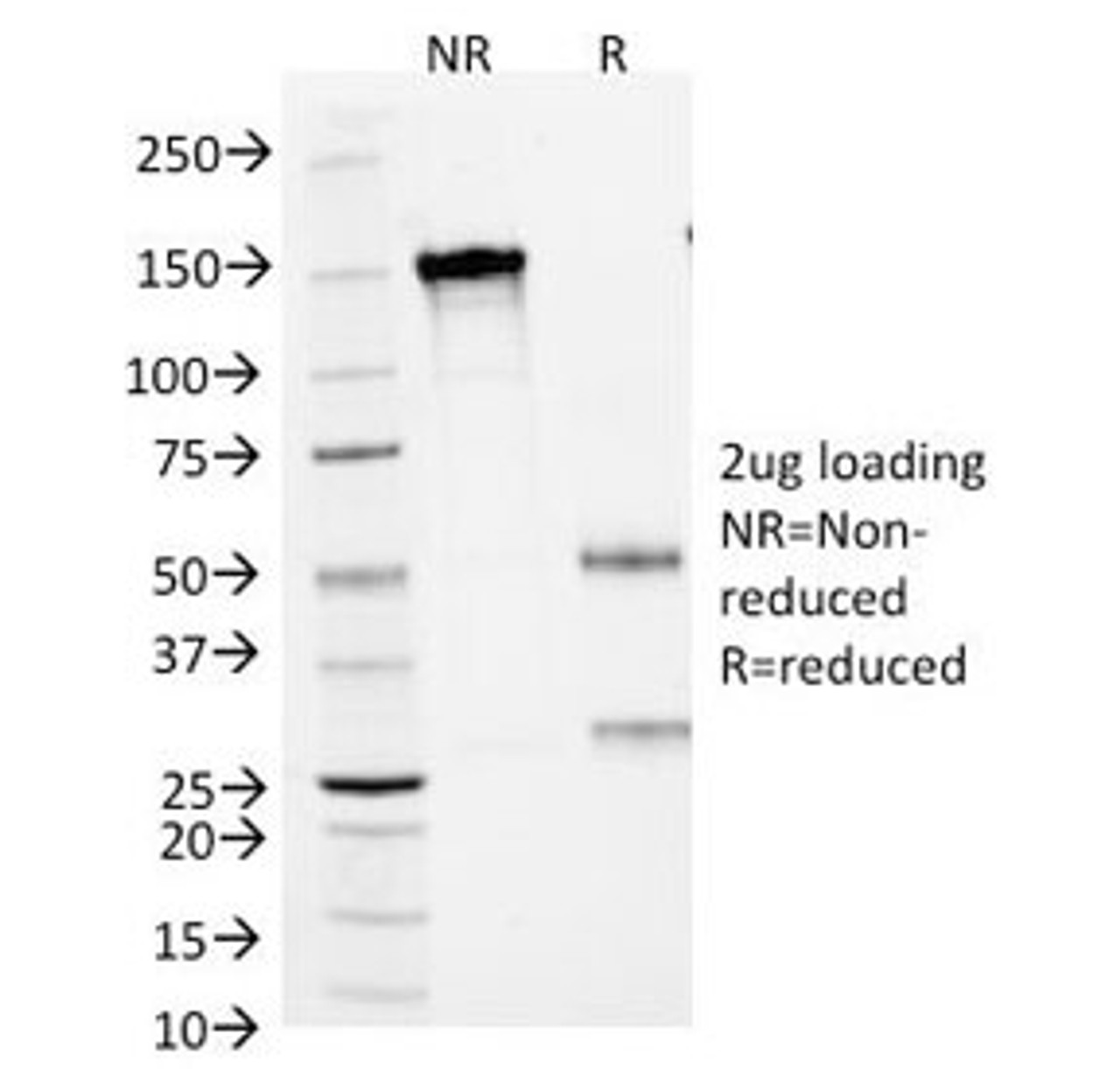 SDS-PAGE Analysis of Purified, BSA-Free SCLC Marker Antibody (clone MOC-52) . Confirmation of Integrity and Purity of the Antibody.