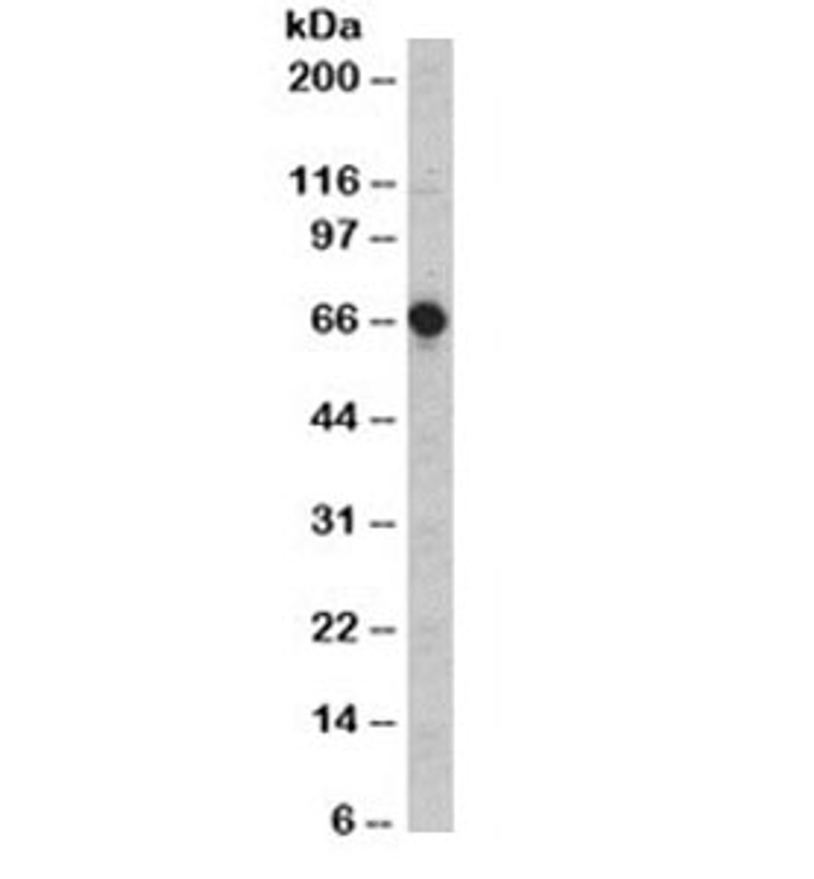 Western blot testing of MOLT4 cell lysate with CD5 antibody (clone CD5/54/F6) . Observed molecular weight 55~67 kDa depending on glycosylation level.