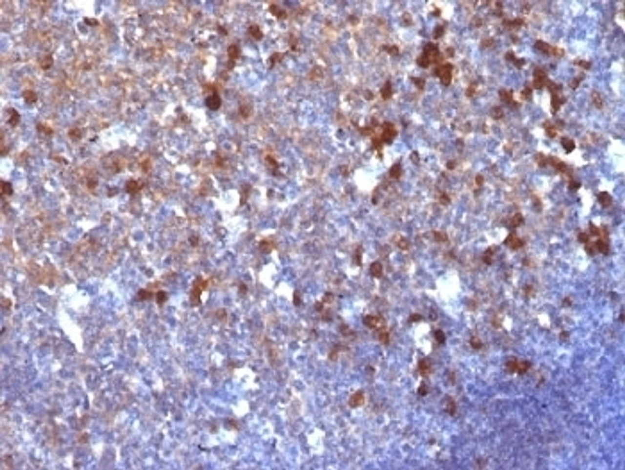 Formalin-fixed, paraffin-embedded human tonsil stained with IgG antibody (IG217)