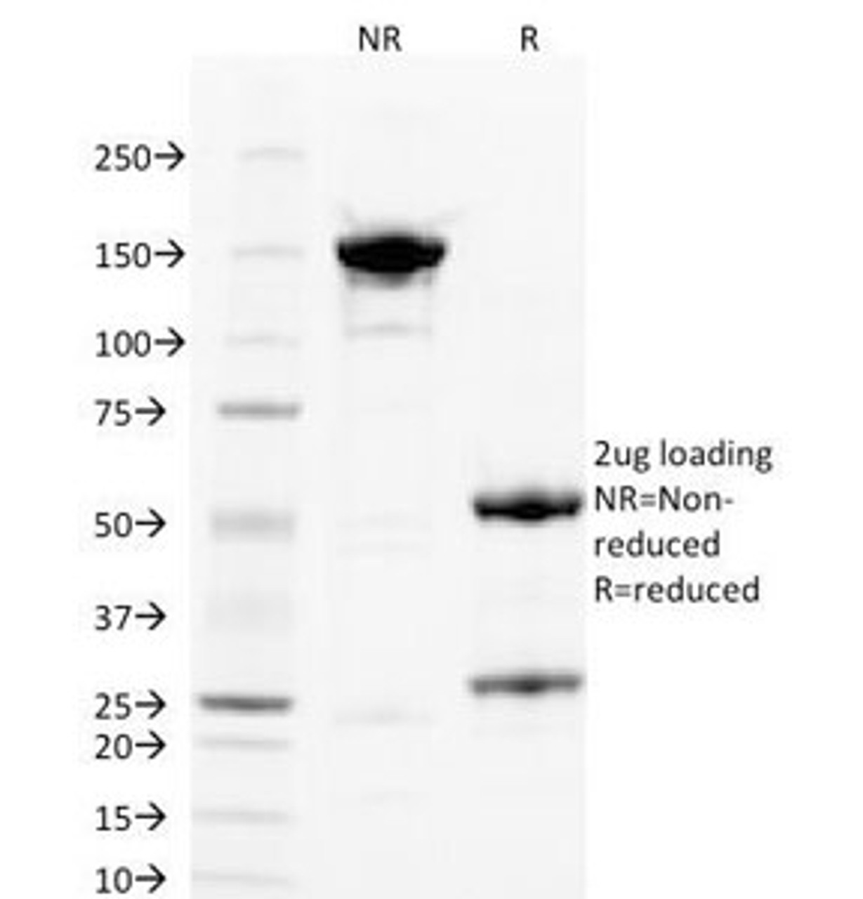 SDS-PAGE Analysis of Purified, BSA-Free PLGF Antibody (clone PLGF/93) . Confirmation of Integrity and Purity of the Antibody.