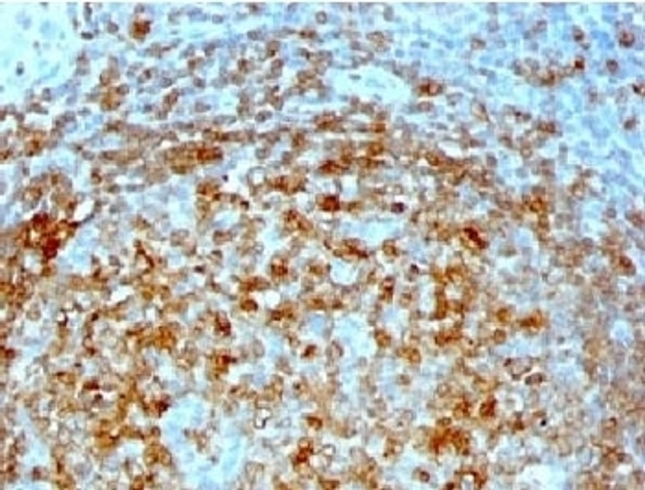 IHC analysis of formalin/paraffin human tonsil with CLIP antibody (CLIP/813)