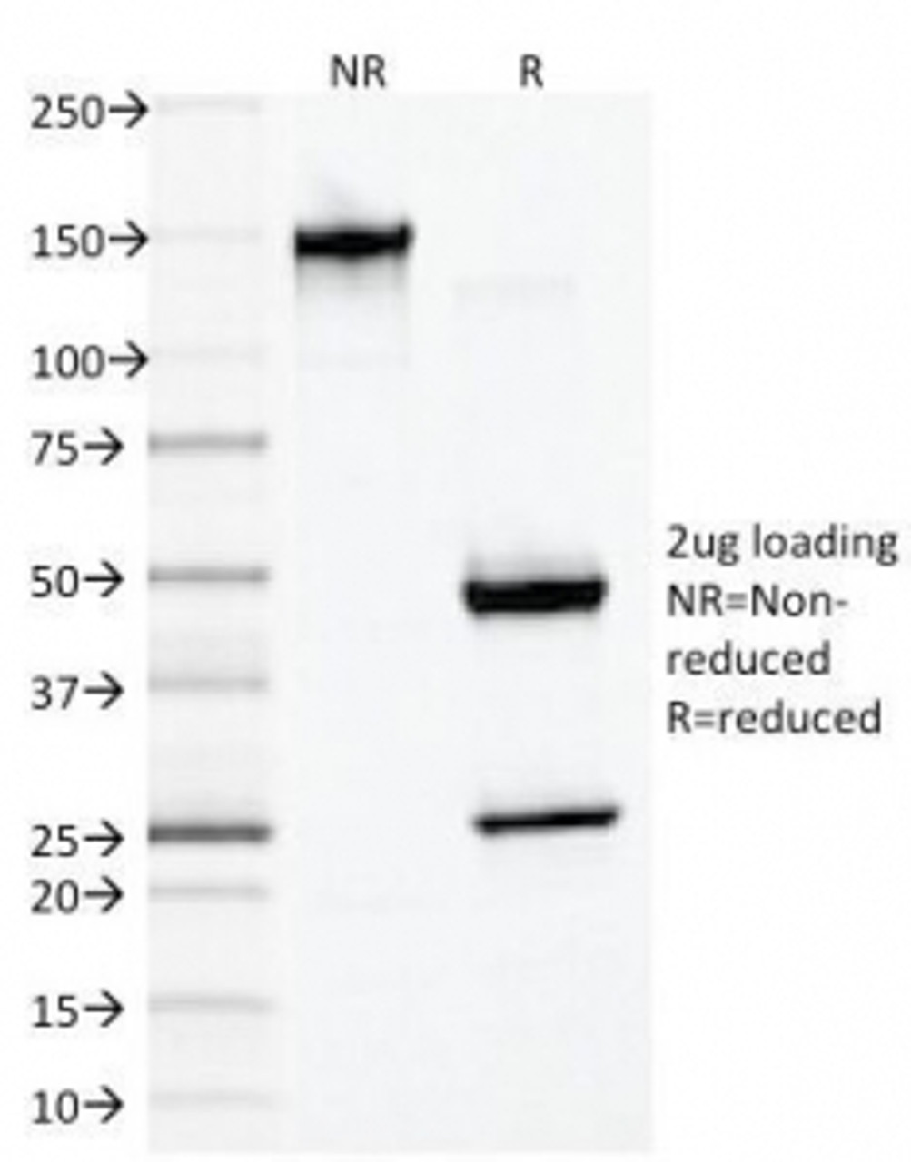 SDS-PAGE Analysis of Purified, BSA-Free Desmin Antibody (clone DES/1711) . Confirmation of Integrity and Purity of the Antibody.