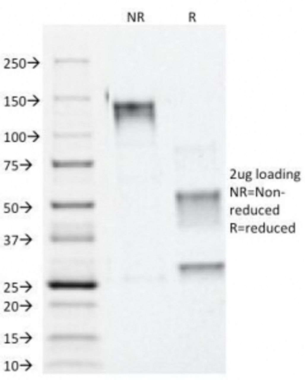 SDS-PAGE Analysis of Purified, BSA-Free Alpha Catenin Antibody (clone 1G5) . Confirmation of Integrity and Purity of the Antibody.