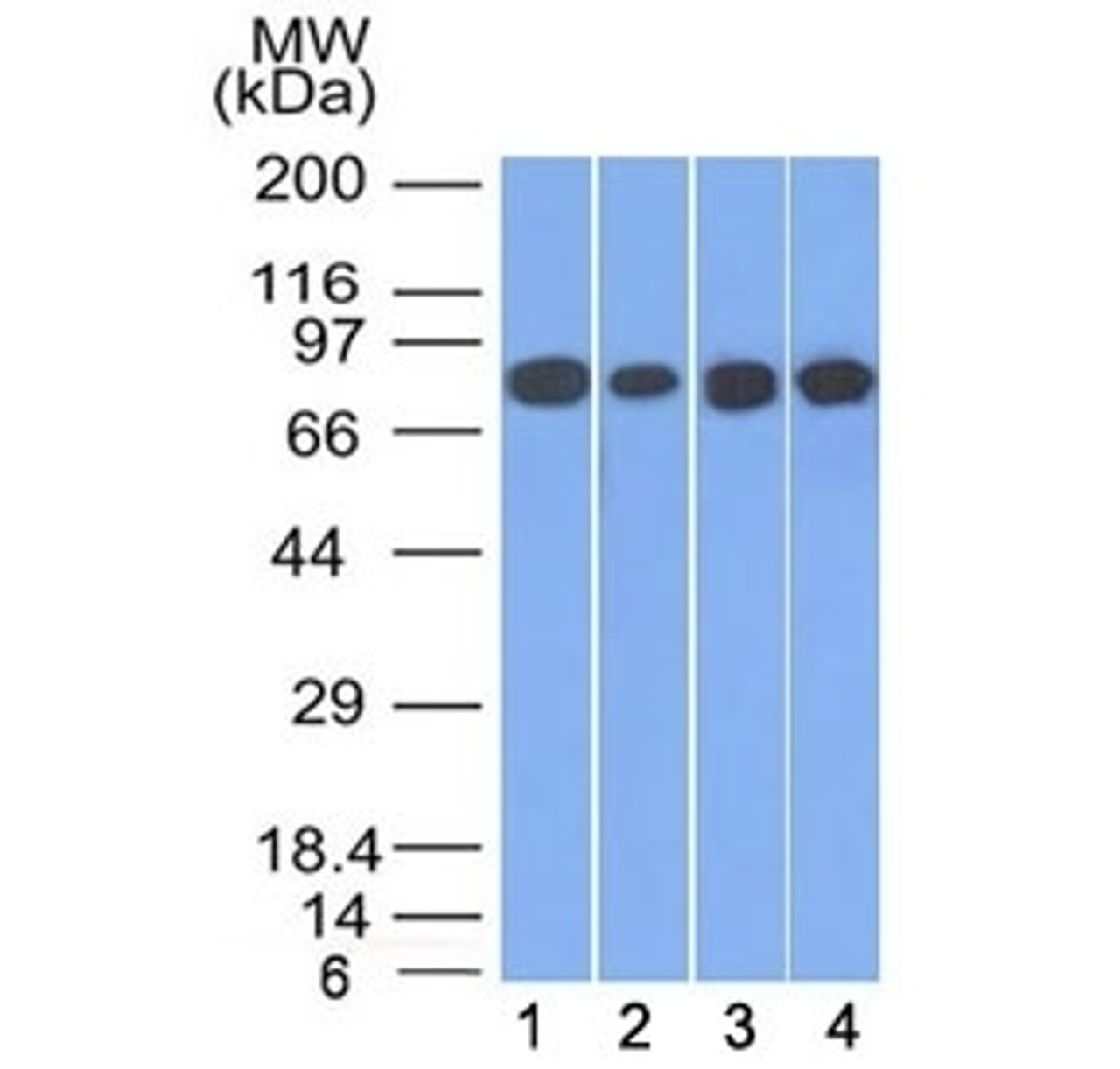 Western blot testing of human 1) HT20, 2) A549, 3) HEK293 and 4) A431 cell lysate with Plakoglobin antibody (clone 11E4) . Predicted molecular weight: 80-87 kDa.