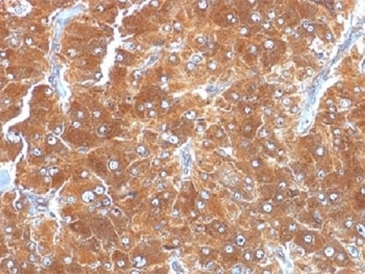 IHC testing of FFPE human adrenal tissue with ADRP antibody (clone ADFP/1494) . Required HIER: steam sections in pH6, 10mM citrate buffer for 10-20 min.