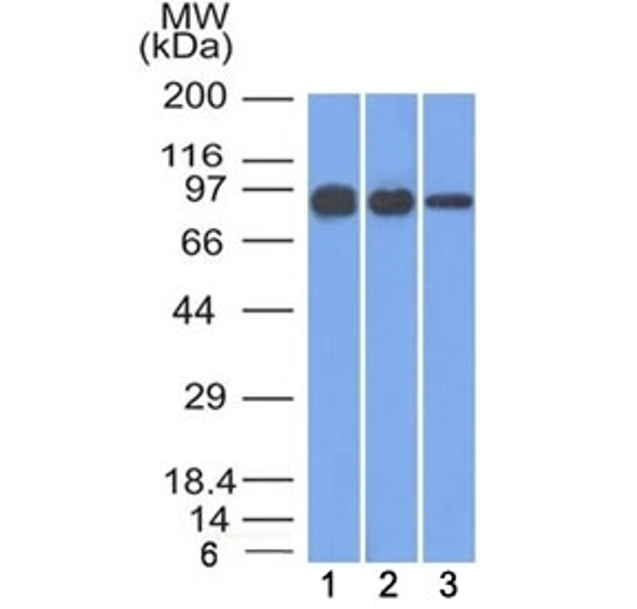Western blot testing of human 1) A431, 2) A549 and 3) MCF7 cell lysate with Beta Catenin antibody (clone 12F7) . Expected molecular weight ~92 kDa.