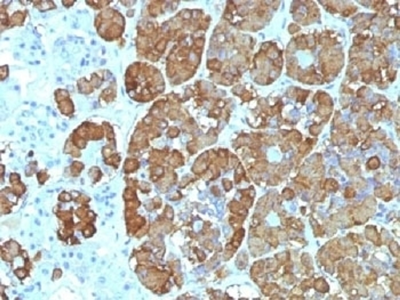 IHC testing of FFPE human pituitary gland with ACTH antibody (clone CLIP/1449) . Required HIER: steam sections in 10mM citrate buffer, pH6, for 10-20 min.