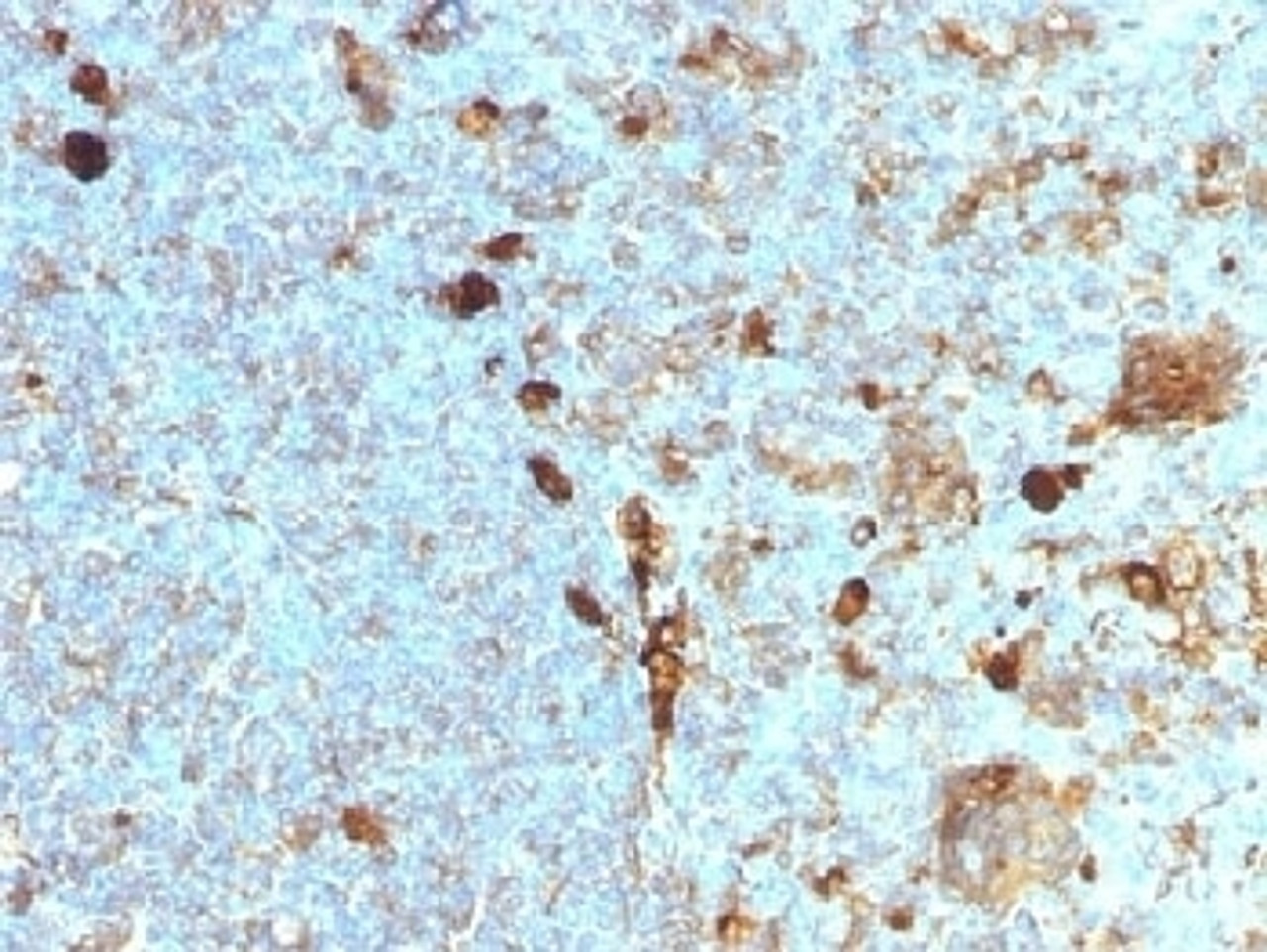 IHC testing of FFPE human tonsil with Alpha 1 Antitrypsin antibody (clone AAT/1378) . Required HIER: steam sections in pH6, 10mM citrate buffer for 10-20 min.