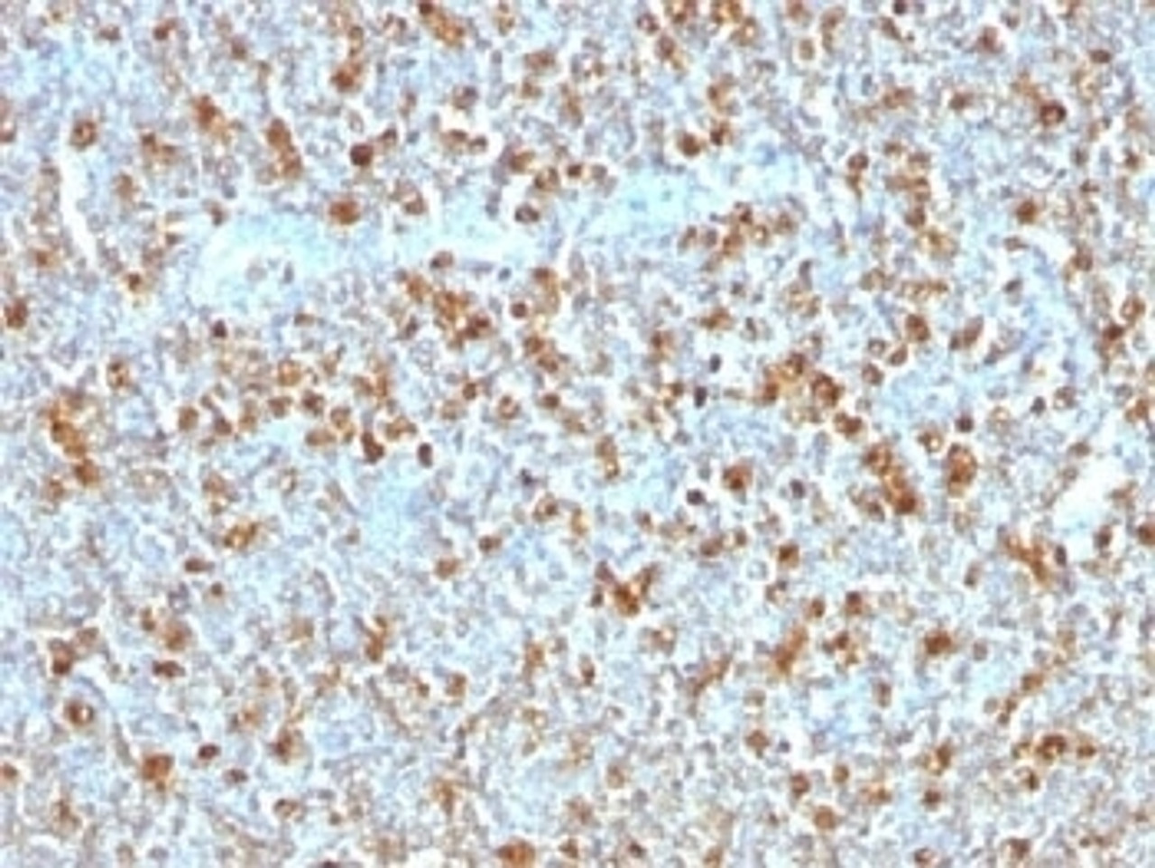 IHC testing of FFPE human tonsil with Alpha 1 Antitrypsin antibody (clone AAT/1379) . Required HIER: steam sections in pH6, 10mM citrate buffer for 10-20 min.