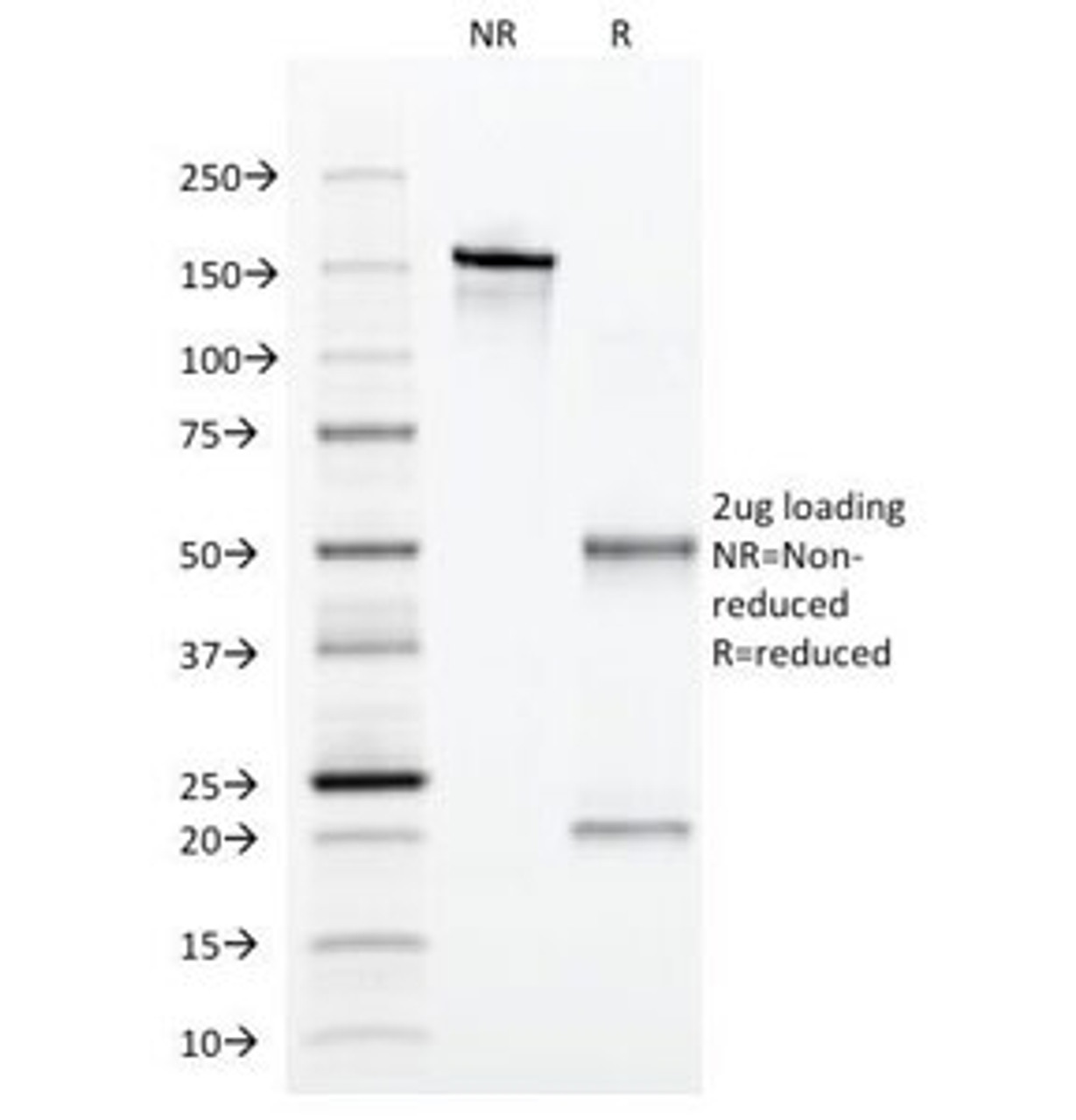 SDS-PAGE Analysis of Purified, BSA-Free Alpha 1 Antitrypsin Antibody (clone AAT/1379) . Confirmation of Integrity and Purity of the Antibody.