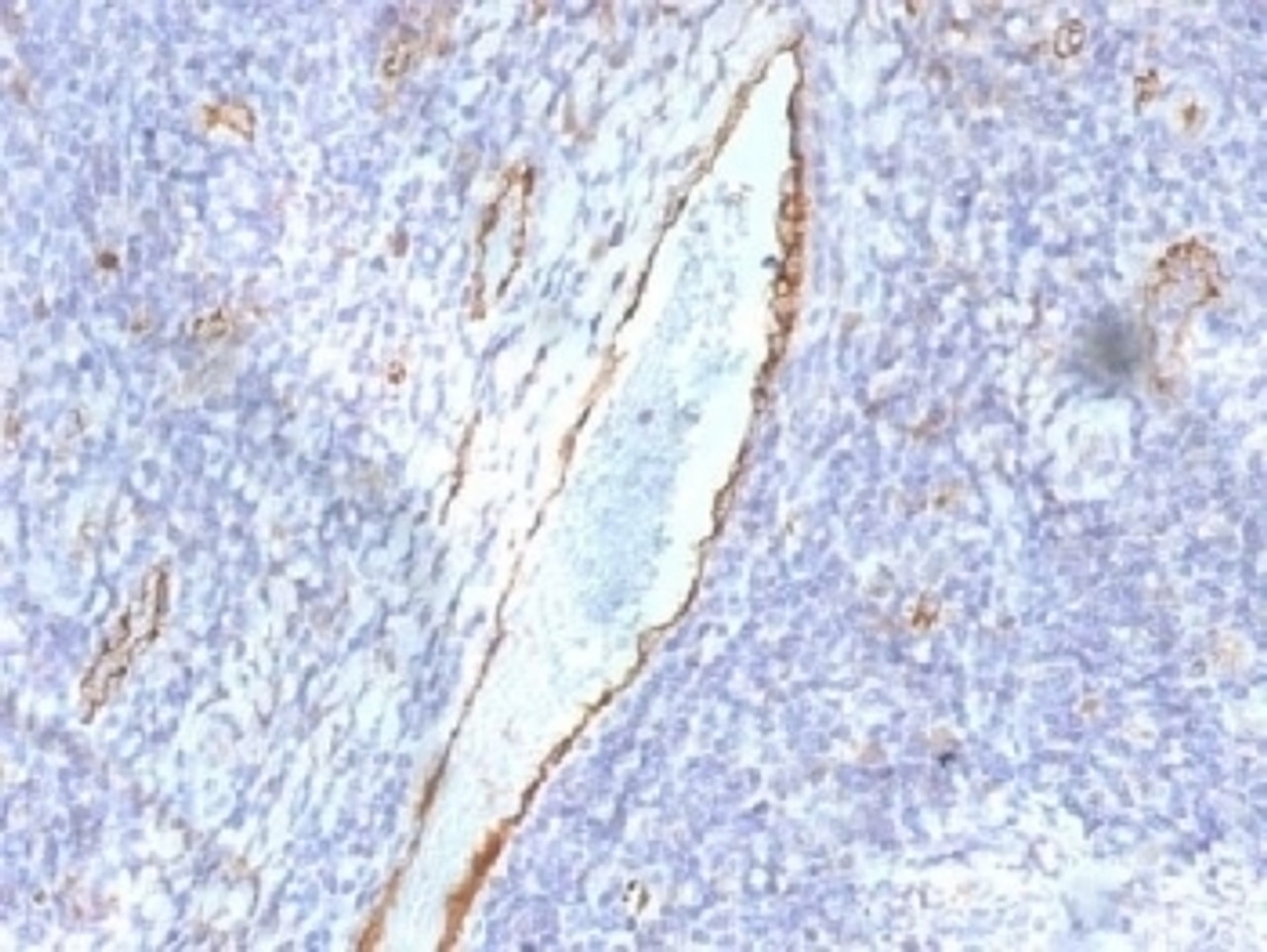 IHC testing of FFPE human tonsil with von Willebrand Factor antibody (clone F8/86) . Required HIER: boil tissue sections in 10mM citrate buffer, pH 6, for 10-20 min followed by cooling at RT for 20 min.