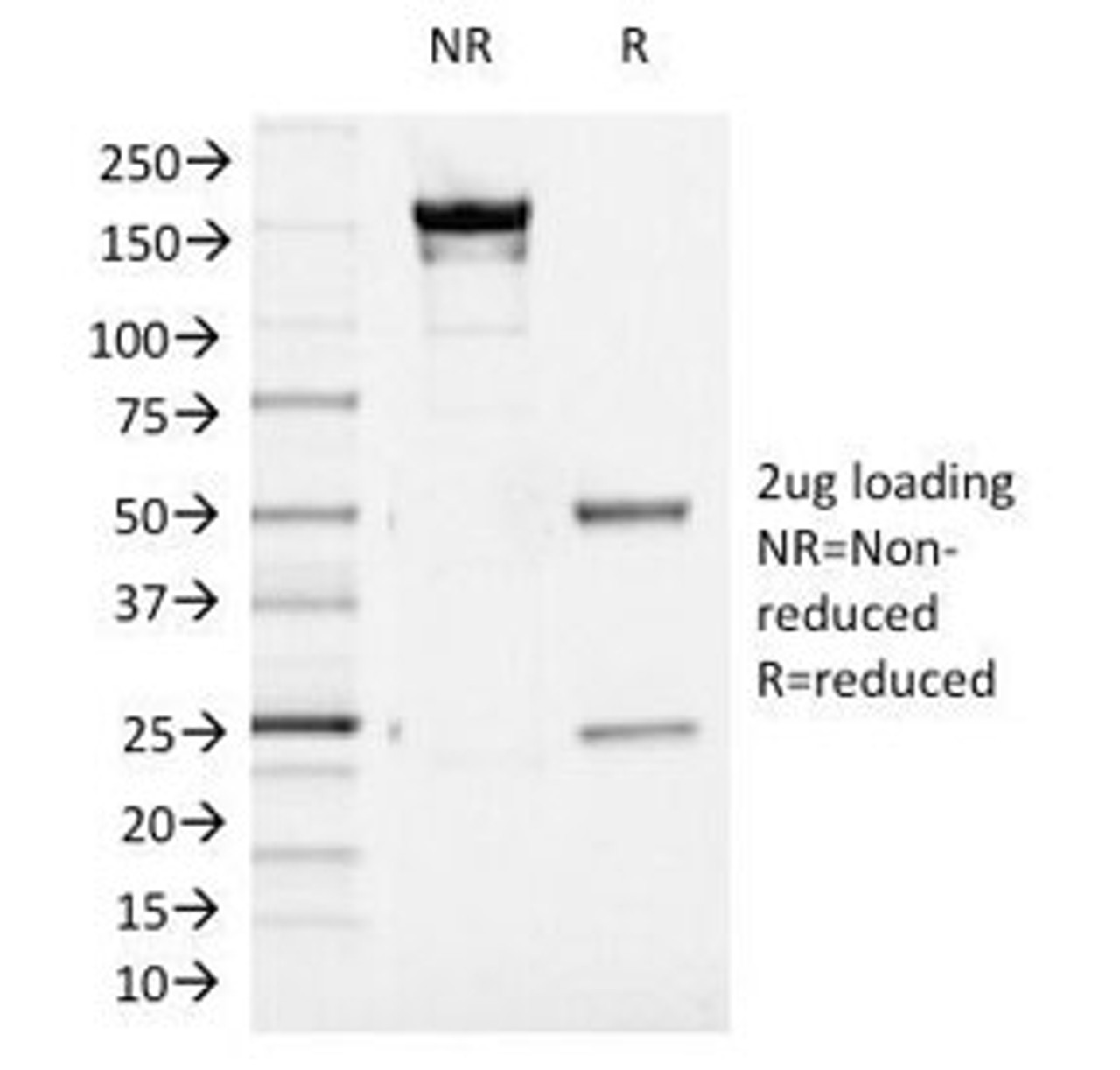 SDS-PAGE Analysis of Purified, BSA-Free Aurora B Antibody (clone AURKB/1521) . Confirmation of Integrity and Purity of the Antibody.