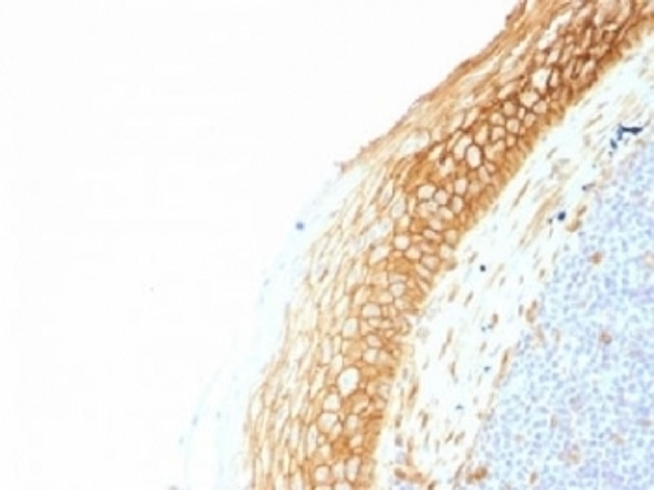 IHC testing of FFPE human tonsil tissue with Beta Catenin antibody (clone CTNNB1/1507) . Required HIER: boil tissue sections in 10mM Tris with 1mM EDTA, pH 9.0, for 10-20 min.