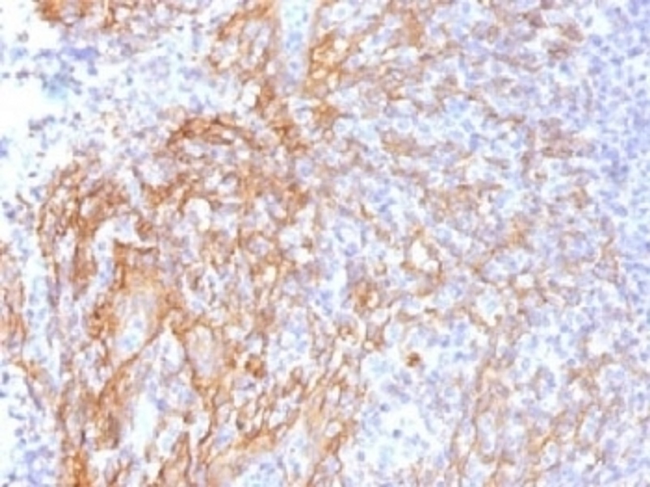 IHC testing of FFPE human tonsil tissue with b-Catenin antibody (clone 6F9) . Required HIER: boil tissue sections in 10mM Tris with 1mM EDTA, pH 9.0, for 10-20 min.