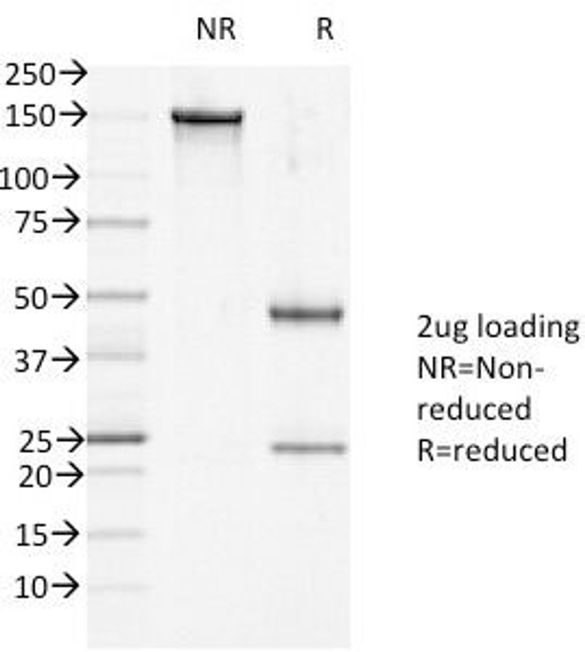 SDS-PAGE Analysis of Purified, BSA-Free DSG1 Antibody (clone 27B2) . Confirmation of Integrity and Purity of the Antibody.