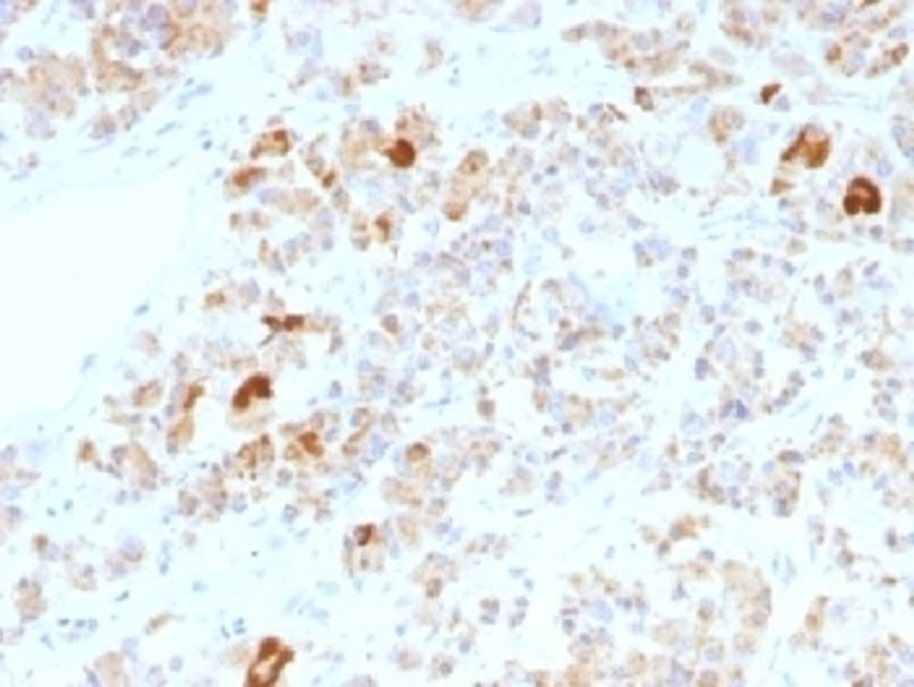 IHC testing of FFPE human pituitary gland stained with Luteinizing Hormone alpha antibody (clone LHa/756) . No HIER required.