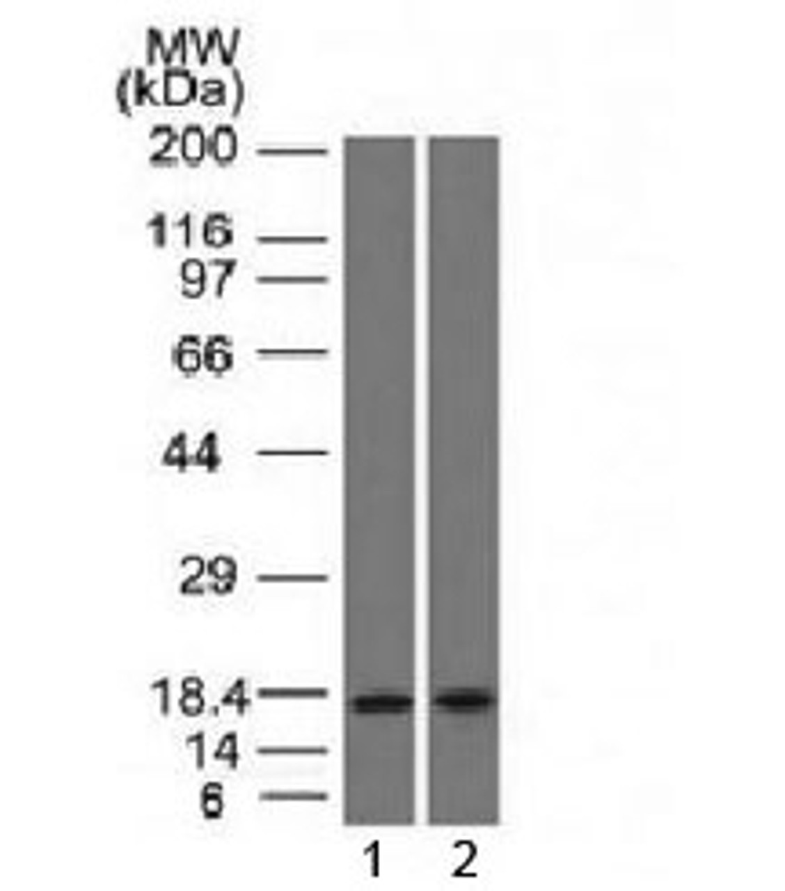 Western blot testing of human 1) pancreas and 2) HepG2 lysate with PIP antibody (clone PIP/1571) . Expected molecular weight ~15 kDa.