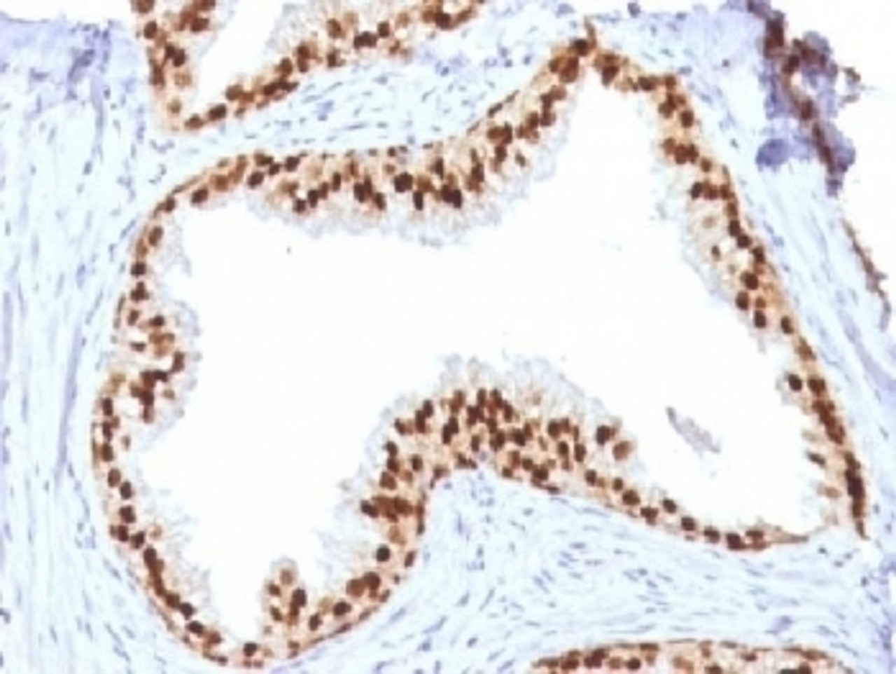 IHC testing of FFPE human prostate with FOXA1 antibody (clone FOXA1/1512) . HIER: boil sections in 10mM Tris with 1mM EDTA, pH9, for 10-20 min.