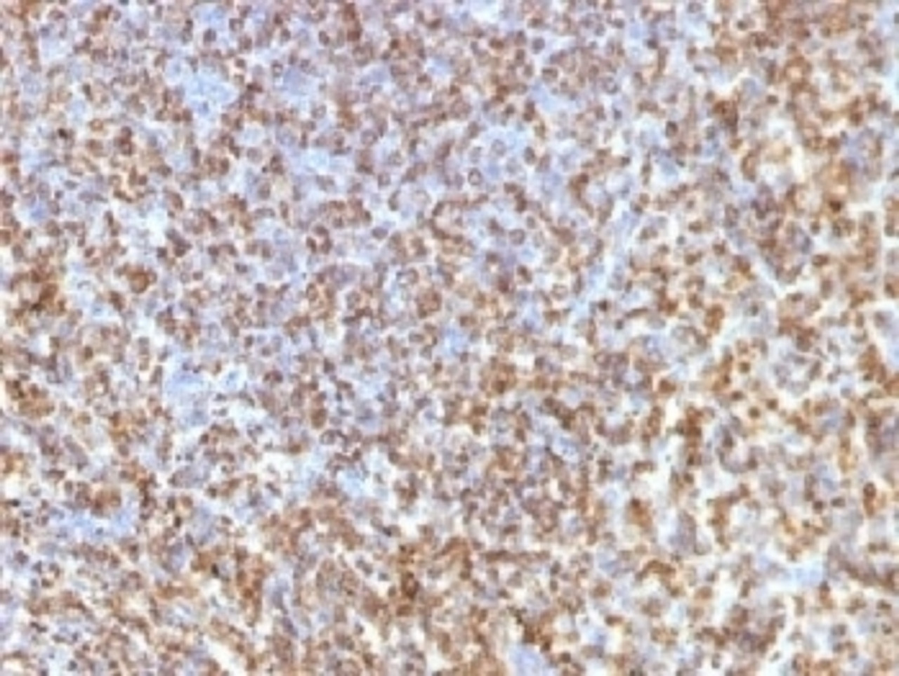 IHC testing of FFPE human spleen with Galectin 13 antibody (clone PP13/1161) . Required HIER: boil tissue sections in 10mM Tris with 1mM EDTA, pH 9 or 10mM Citrate buffer, pH 6, for 10-20.