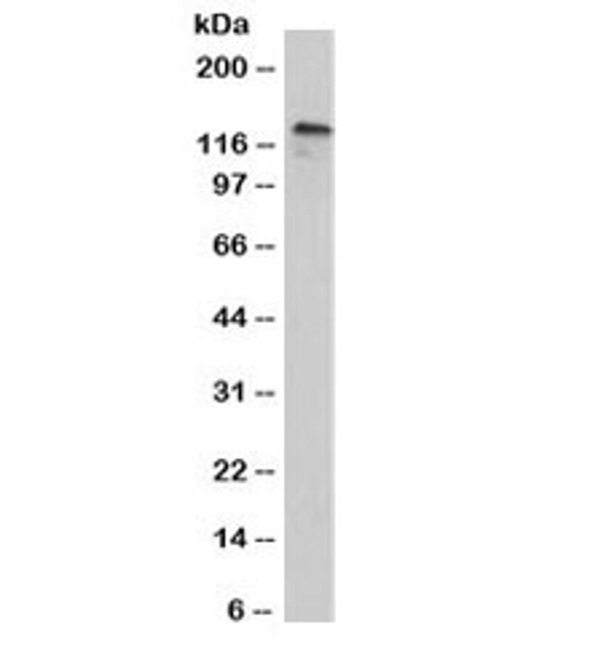 Western blot testing of human A431 cell lysate with P-Cadherin / CDH3 antibody (clone 12H6) . Expected molecular weight: ~91 kDa (unmodified) , 100~130 kDa (glycosylated) .