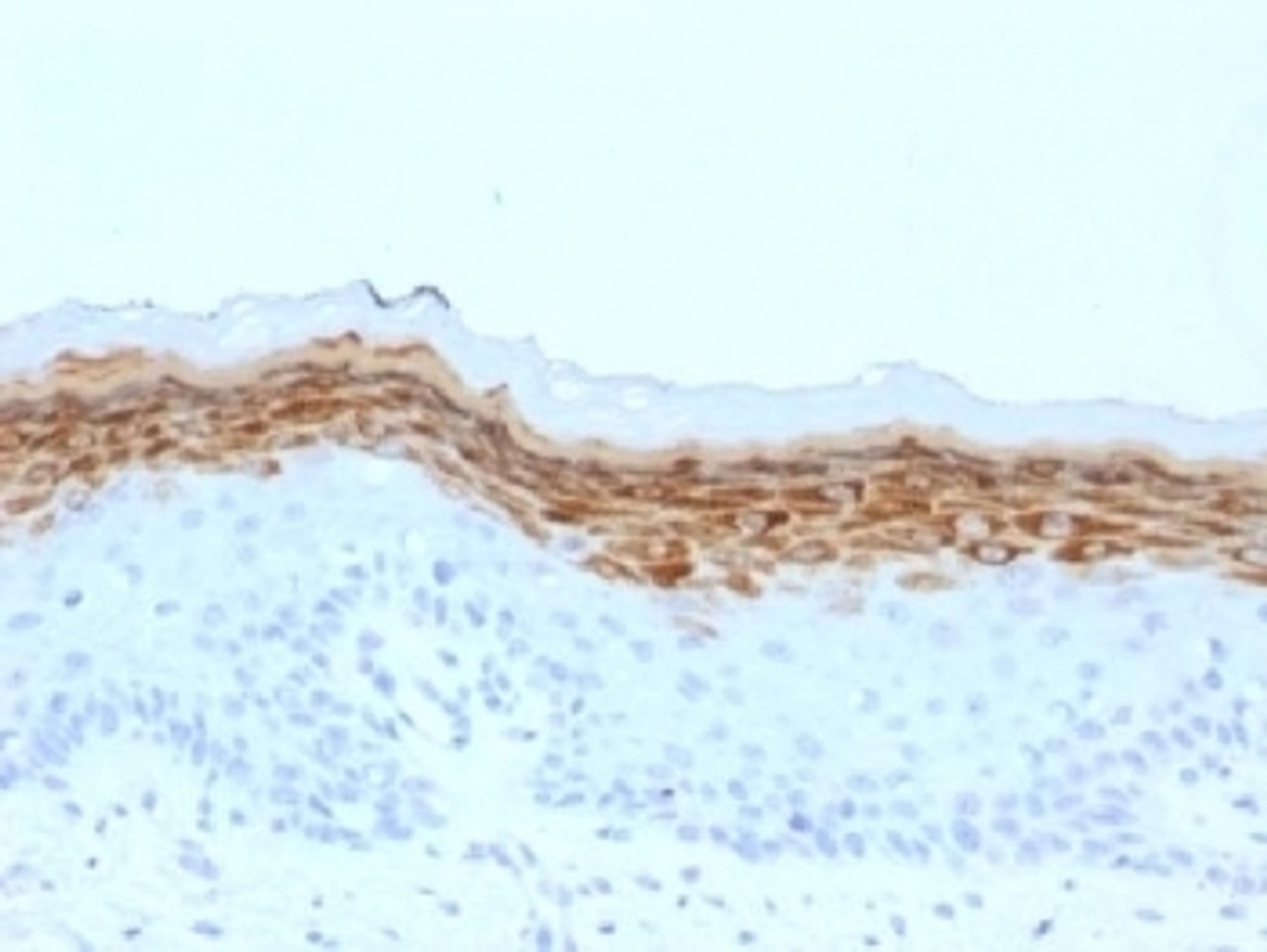 IHC testing of FFPE human skin with Filaggrin antibody (clone FLG/1561) . Required HIER: boil tissue sections in 10mM citrate buffer, pH 6, for 10-20 min.