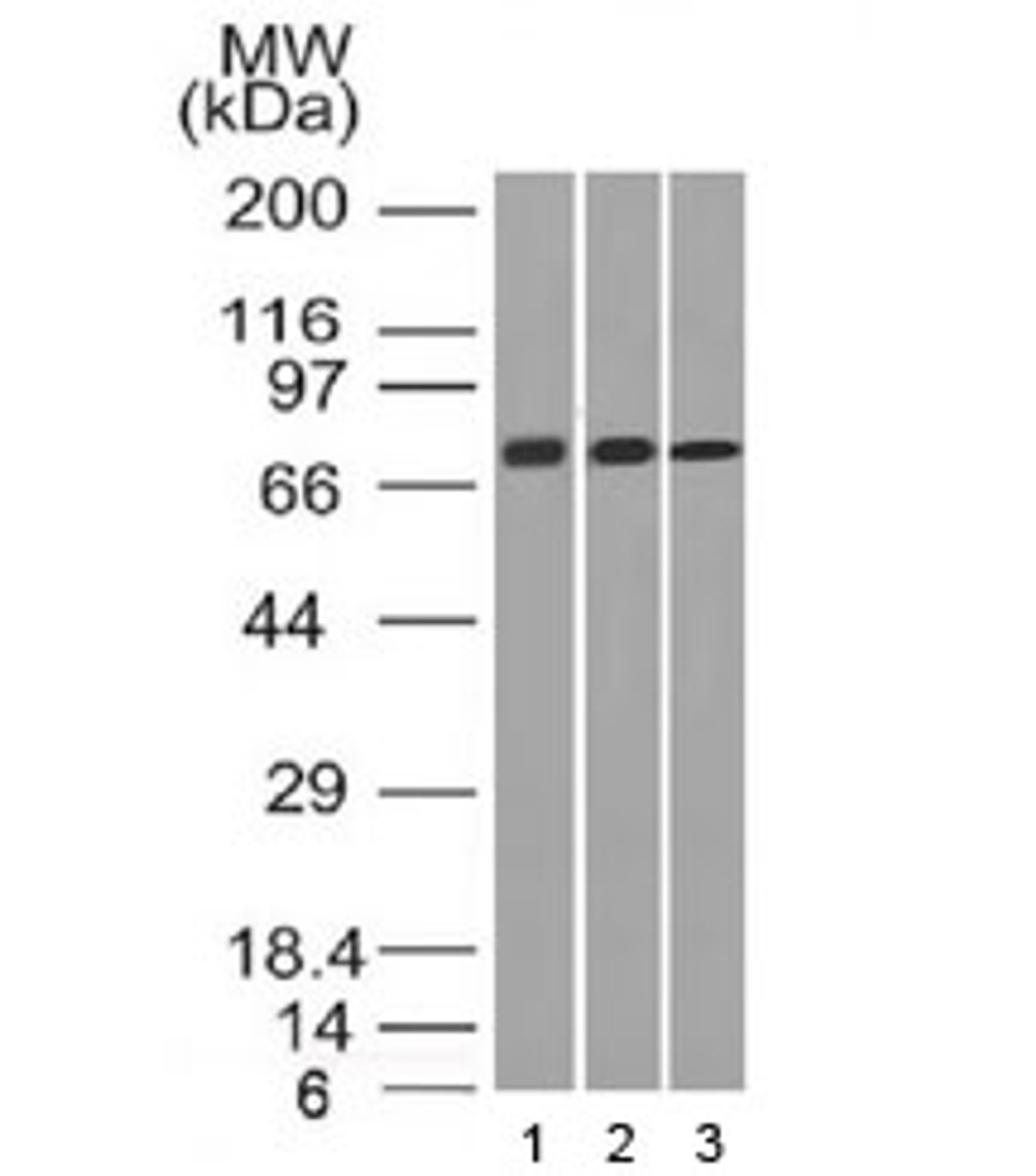 Western blot testing of human 1) HeLa, 2) A431 and 3) HL60 cell lysate with CD105 antibody (clone ENG/1326) . Observed molecular weight: 70/90 kDa (monomer, unmodified/glycosylated) ; 140-180 kDa (dimer, unmodified/glycosylated) .