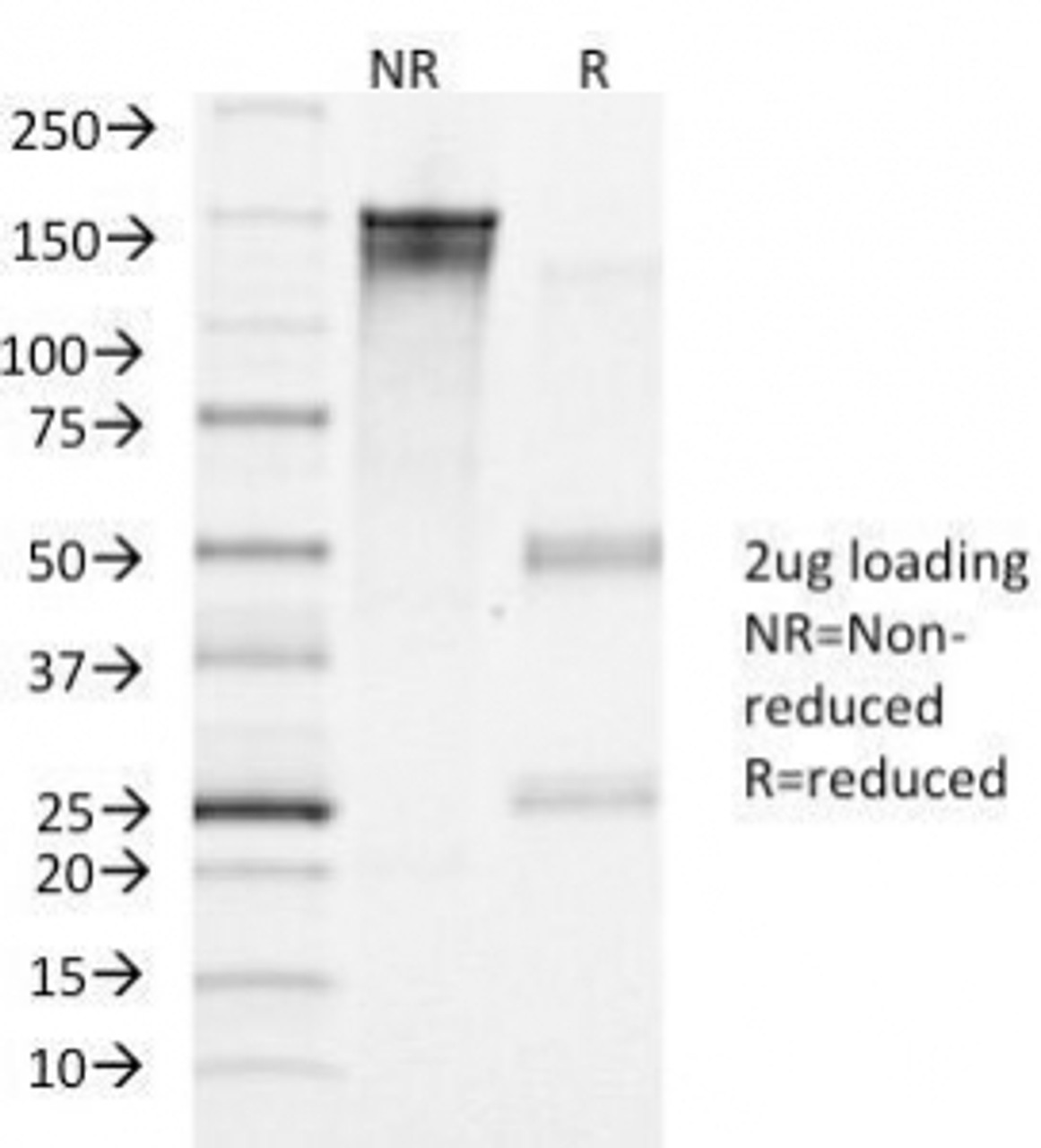 SDS-PAGE Analysis of Purified, BSA-Free LHR Antibody (clone LHCGR/1417) . Confirmation of Integrity and Purity of the Antibody.