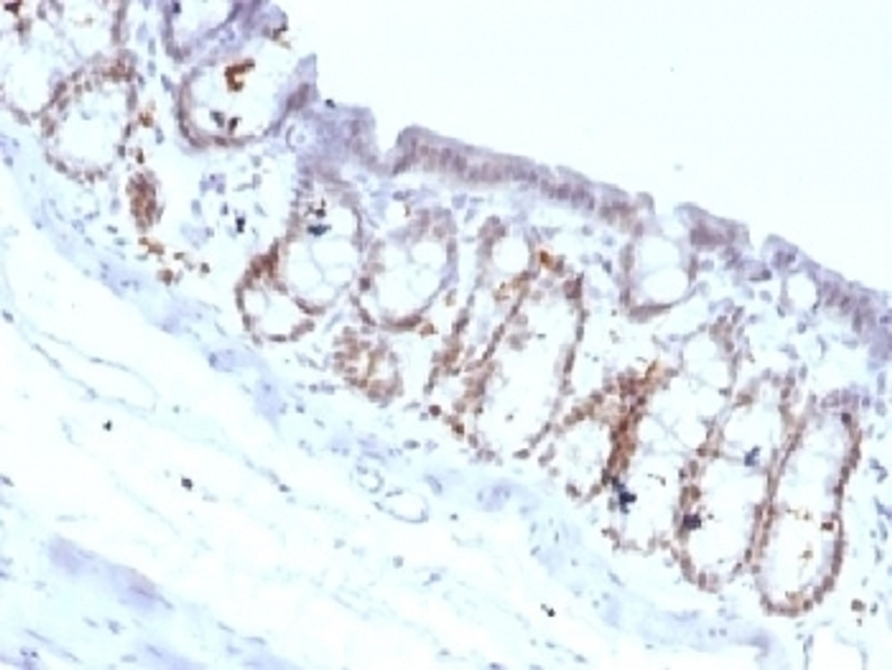 IHC testing of FFPE rat colon with FOXA1 antibody (clone FOXA1/1518) . HIER: boil sections in 10mM Tris with 1mM EDTA, pH9, for 10-20 min.