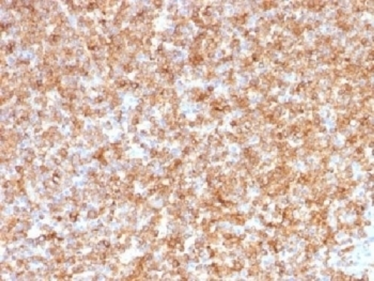 IHC testing of FFPE human tonsil tissue with HLA-DP/DQ/DR antibody (clone CR3/43) . Required HIER: boil tissue sections in 10mM citrate buffer, pH 6, for 10-20 min.