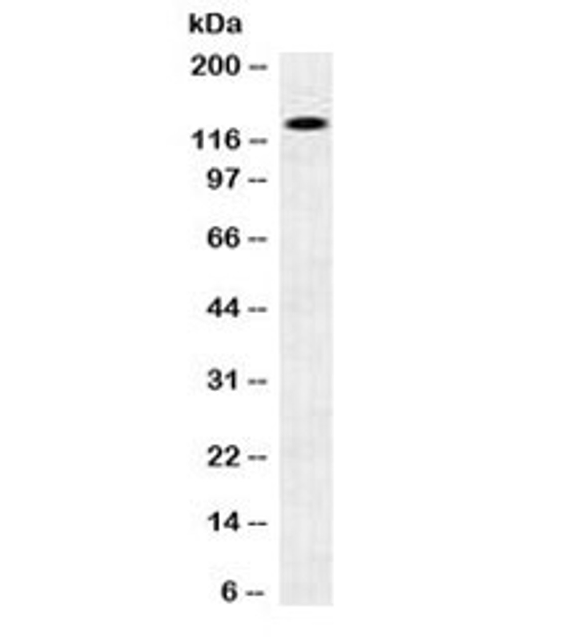 Western blot testing of human brain lysate with N-Cadherin antibody. Predicted molecular weight ~100 kDa (unmodified) , 125-140 kDa (modified) .