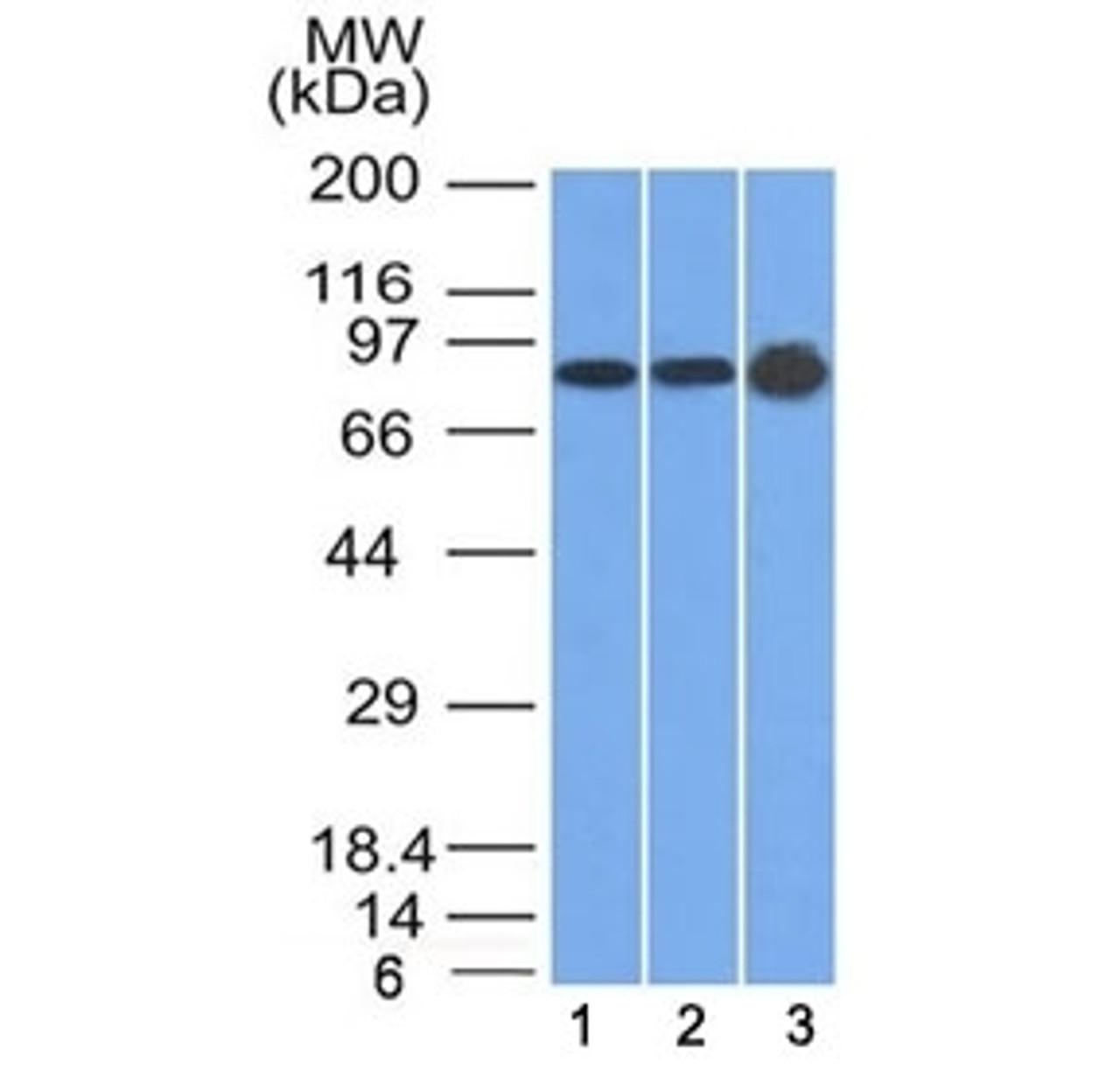 Western blot testing of human 1) U87, 2) HeLa and 3) A431 cell lysate with Plakophilin 1 antibody (clone 10B2) . Expected molecular weight: 75-83 kDa.