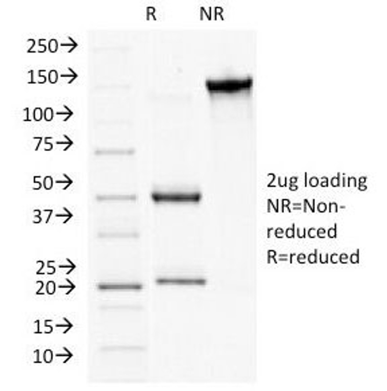 SDS-PAGE Analysis of Purified, BSA-Free Plakophilin 1 Antibody (clone 10B2) . Confirmation of Integrity and Purity of the Antibody.