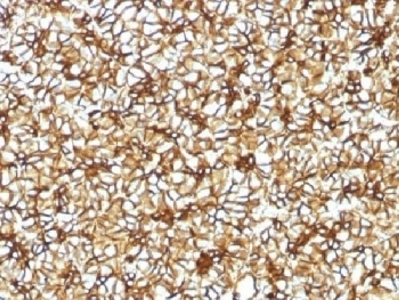 IHC testing of FFPE human pancreas with Spectrin beta III antibody (clone SPTBN2/1582) . Required HIER: boil tissue sections in 10mM citrate buffer, pH 6, for 10-20 min followed by cooling at RT for 20 min.