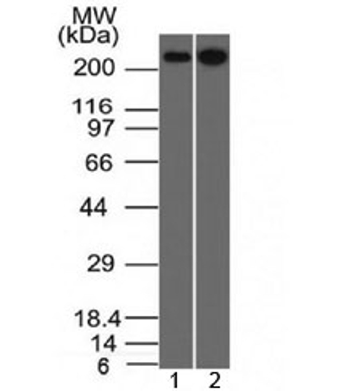 Western blot testing of human 1) HeLa and 2) HEK293 cell lysate with Spectrin beta III antibody (clone SPTBN2/1582) . Predicted molecular weight ~246 kDa.