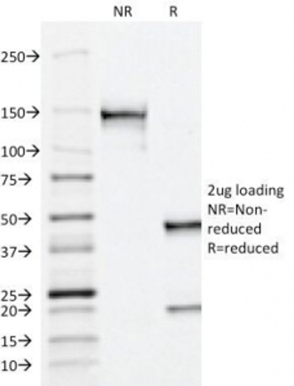 SDS-PAGE Analysis of Purified, BSA-Free PSAP Antibody (ACCP/1338) . Confirmation of Integrity and Purity of the Antibody.