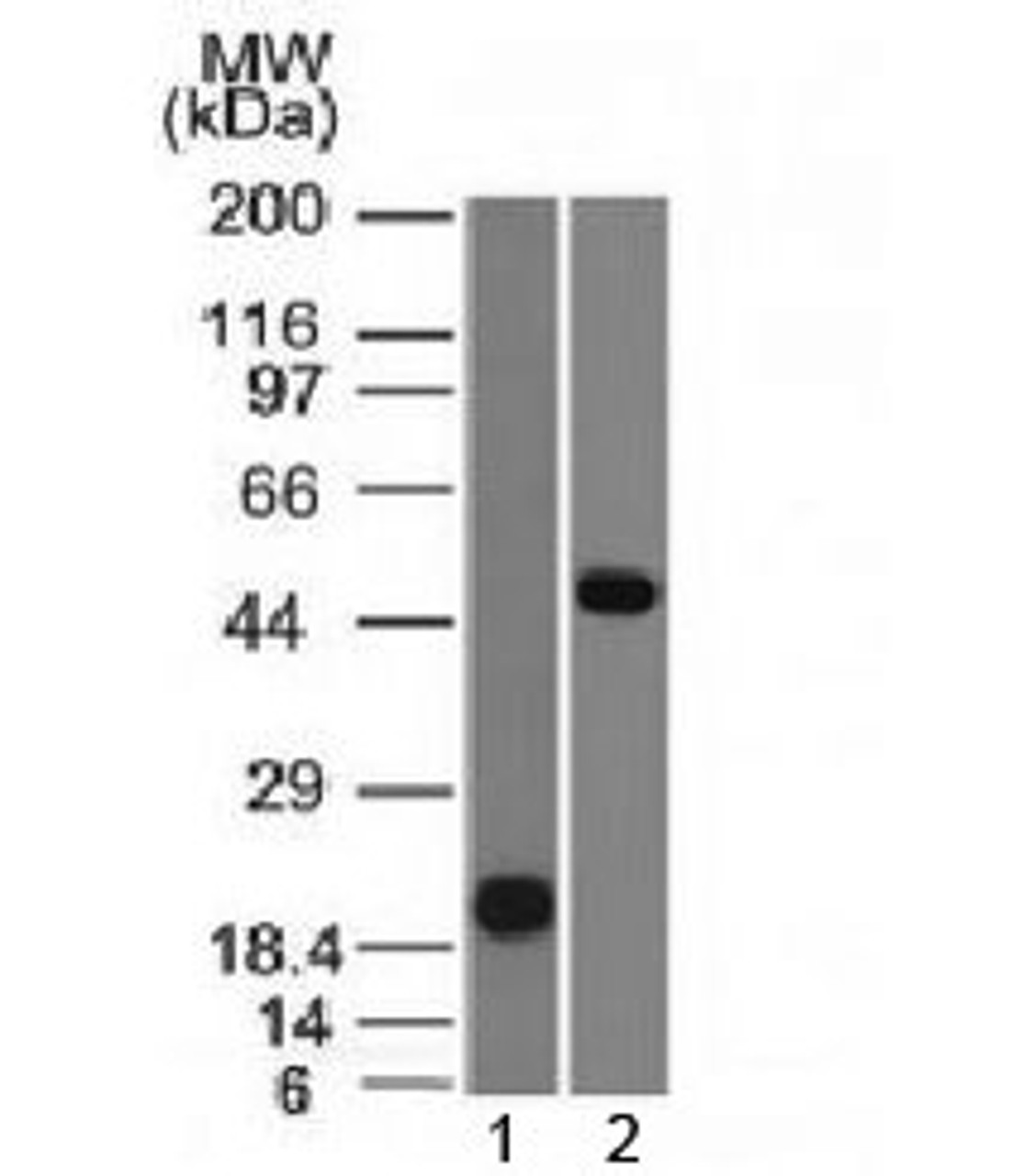 Western blot testing of 1) human partial recombinant protein and 2) human Raji cell lysate with PAX-8 antibody (clone PAX8/1491) . Predicted molecular weight of isoforms 1-5: 31, 35, 42, 43 and 48 kDa, respectively. PAX-8 can also be observed at ~62 kDa.