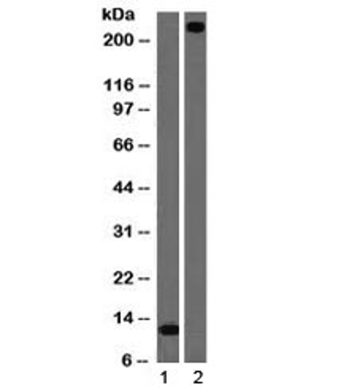 Western blot testing of 1) partial recombinant protein and 2) human lung lysate with vWF antibody (clone VWF/1465) . Predicted molecular weight ~250 kDa.