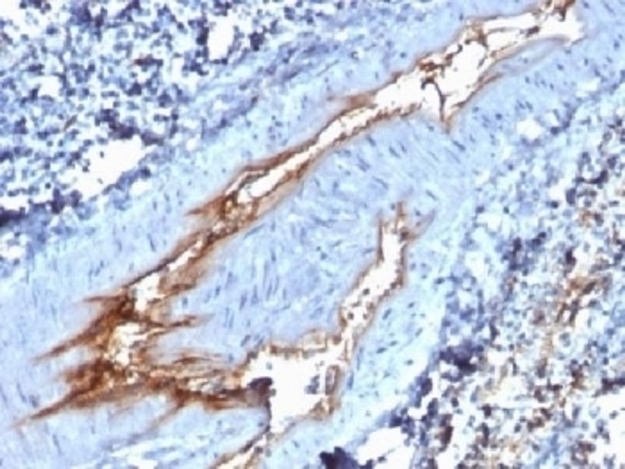 IHC testing of FFPE human spleen with vWF antibody (clone VWF/1767) . Required HIER: boil tissue sections in 10mM citrate buffer, pH 6, for 10-20 min followed by cooling at RT for 20 min.