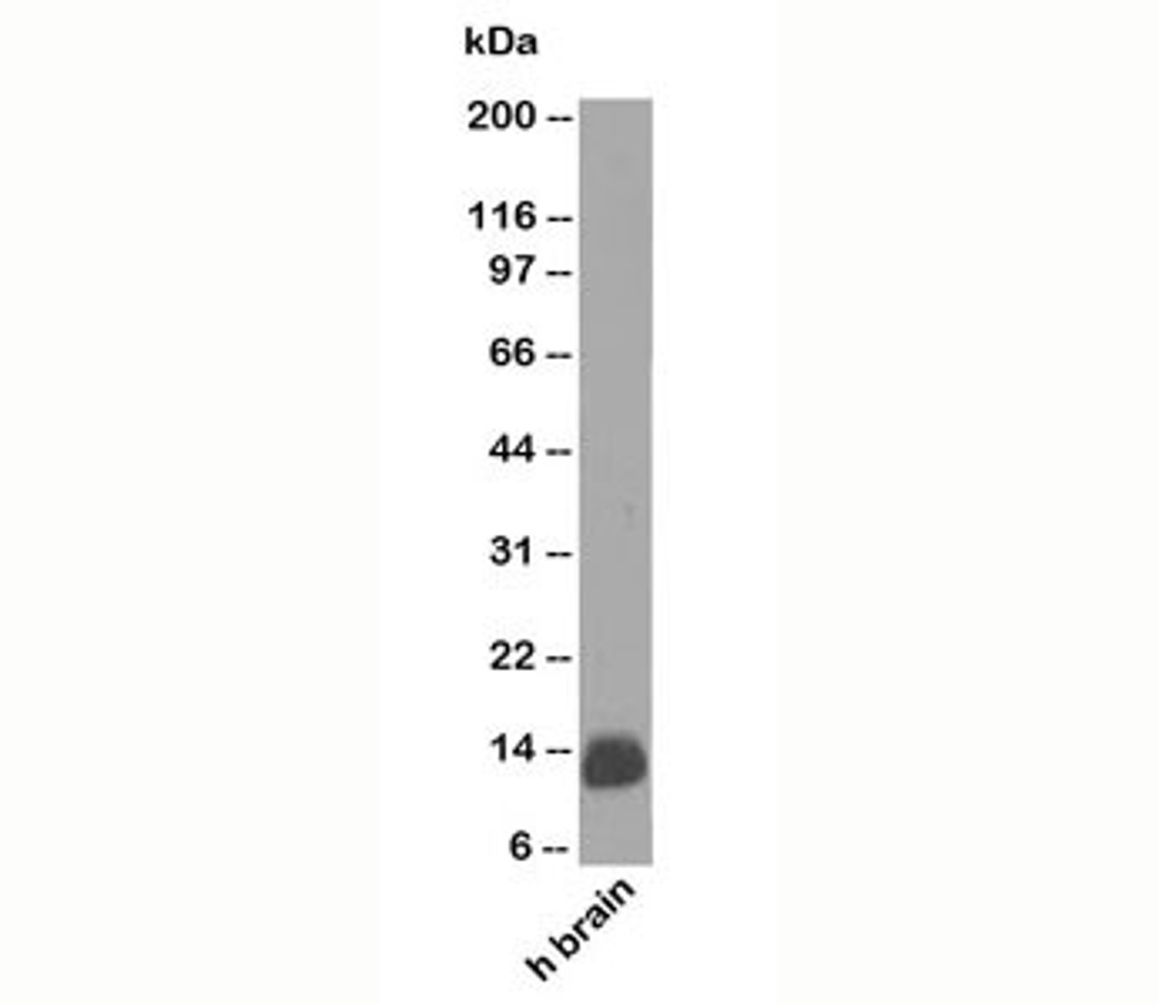 Western blot testing of human samples using S100B antibody (clone 4C4.9) . Predicted molecular weight: 12-15 kDa.