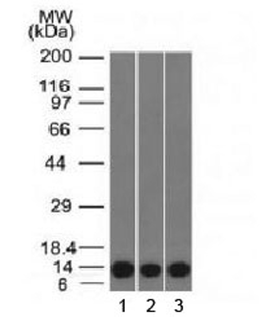 Western blot testing of human 1) HeLa, 2) A549 and 3) A431 cell lysate FSP1 antibody. Predicted molecular weight ~12 kDa.